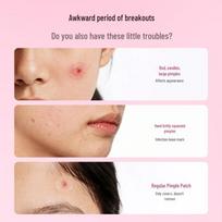 AIREE Star-Shaped Hydrocolloid Acne Patches with Mirror Case beige