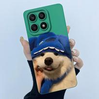 For Honor X8a CRT-LX1 LX2 LX3 Funda Honor X8b LLY-LX1 LX2 LX3 X 8B 4G Soft Silicone Phone Case Sweet Lovely Printed Cover Shell Honor X8a blue