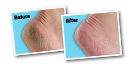 ranku kremas - O'Keeffe's For Healthy Feet 96g - 2 nuotrauka