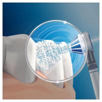 oral b antgalis - Braun Oral-B OxyJet + 2000 Electric Toothbrush White - 5 nuotrauka