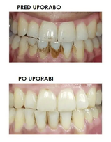 silk'n - Elektrinis dantų šepetėlis Silkn ToothWave TW1PE3001, baltas - 8 nuotrauka