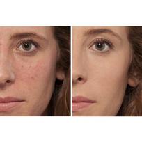 loreal true match eurokos - Loreal True Match The One maskuoklis - 1R/C Ivory Rose - 4 nuotrauka