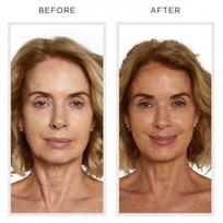 vita liberata idegio -  VITA LIBERATA savaiminio įdegio serumas veidui ANTI-AGE, bekvapis, 1 vnt. - 2 nuotrauka