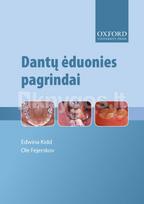 Dantų ėduonies pagrindai