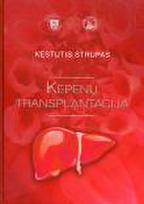 Kepenų transplantacija