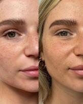 self tan - Savaiminio įdegio lašai veido odai Tan Luxe The Face Anti Age Self Tan Drops Medium / Dark, 30 ml - 2 nuotrauka
