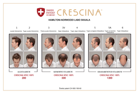 ampules plaukams -  CRESCINA ampulių kompleksas vyrų plaukų slinkimo stabdymui ir plaukų atauginimui TRANSDERMIC COMPLETE TREATMENT HFSC 500 (10 + 10), 20 ampulių - 3 nuotrauka