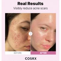 cosrx the niacinamide - COSRX The Niacinamide 15 Serum , 20 ml - 3 nuotrauka