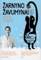 Žarnyno žavumynai. Viskas apie menkai vertinamą organą