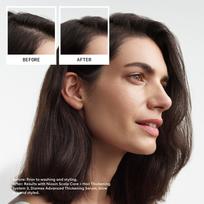 nioxin pro clinical - Nioxin Nioxin rinkinukas - NIOX TRIALKIT SYS3, 1 kompl - 2 nuotrauka