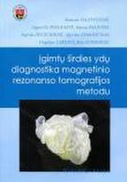 Įgimtų širdies ydų diagnostika magnetinio rezonanso tomografijos metodu