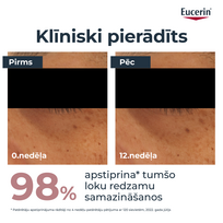 aky - EUCERIN paakių kremas ANTIPIGMENT, 15 ml - 5 nuotrauka