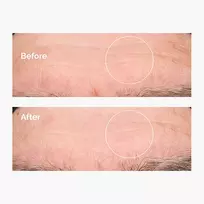 the ordinary - The Ordinary Hyaluronic Acid 2% + B5 drėkinamasis serumas veidui - 30 ml. - 3 nuotrauka