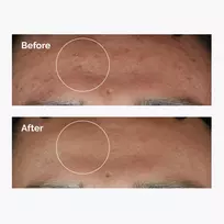 the ordinary - The Ordinary Niacinamide 10% + Zinc 1% serumas veidui - 30 ml. - 3 nuotrauka