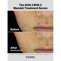 aha bha 30 ml - Cosrx – The AHA 2 BHA 2 Blemish Treatment serumas 30 ml - 3 nuotrauka