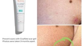 geles - Avene Cicalfate+ gelis randams 40ml - 2 nuotrauka