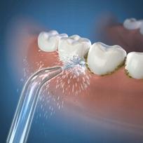 150 - Waterpik WF-150 balta (White) - 5 nuotrauka