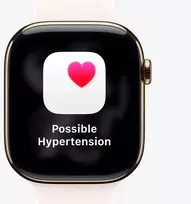 series 11 - Apple Watch Series 11 GPS 42mm Juodas (Jet Black) Aliuminio Korpusas su Juodu Sportiniu Dirželiu - M/L - 6 nuotrauka