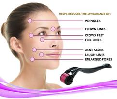 derma roller 1.0 mm - Kosmeda priemonės adatinis volelis mezoterapijai su 540 medicininio plieno adatomis, ilgis 1,00 mm - 5 nuotrauka