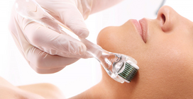 derma roller 1.0 mm - Activeshop DERMA ROLLER mezoterapijai 1,0 mm Rose Gold (Rožinis auksas) - 3 nuotrauka
