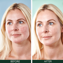 spf 50 - SORTED SKIN  "5 in 1" Dieninis kremas raustančiai odai SPF50, 30 ml - 2 nuotrauka