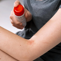 niezejimo - SVR Cicavit+ Sauce Grattage raminantis purškiklis nuo niežėjimo ir įbrėžimų, 40 ml - 2 nuotrauka