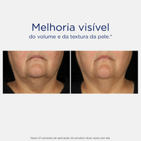 neostrata - NEOSTRATA serumas TRI-THERAPY LIFTING, 30 ml - 2 nuotrauka