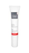 Ziaja Med Anti-Wrinkle Treatment Smoothing 15ml Moterims Akių kremai